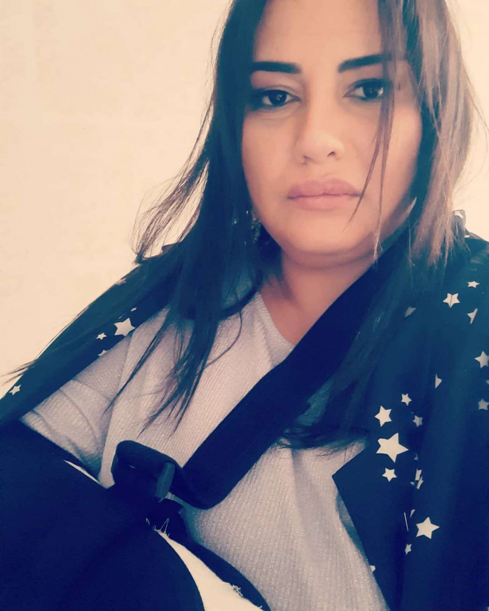 Azərbaycanlı aparıcının biləyi qırıldı -FOTOLAR