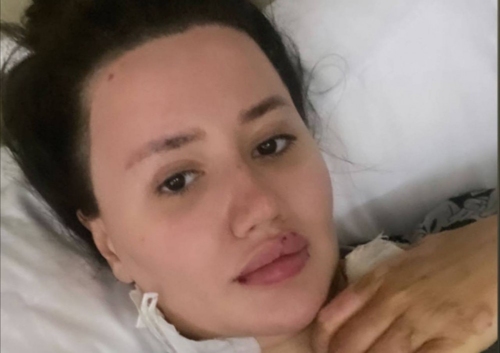 Gec klubundakı partlayışda xəsarət alan Aysel baş verənlərlə bağlıgörün nə danışıb - FOTOLAR