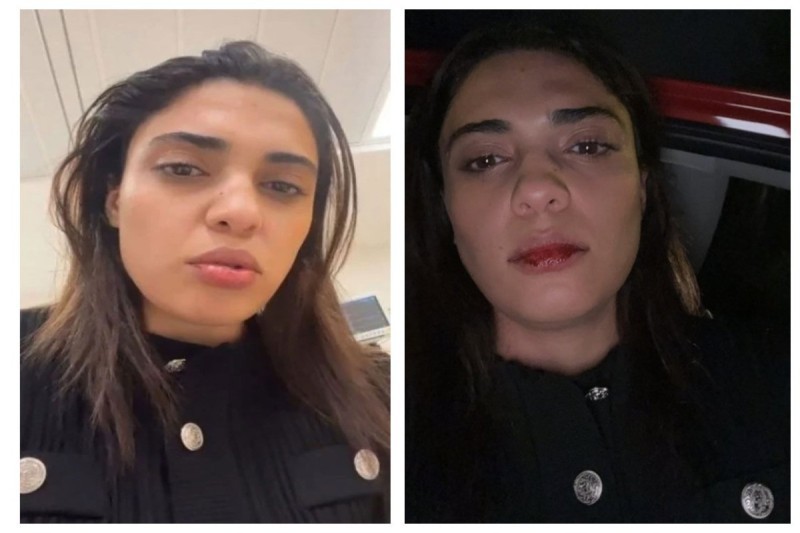 Azərbaycanlı müğənni İstanbuldadöyüldü (FOTO)