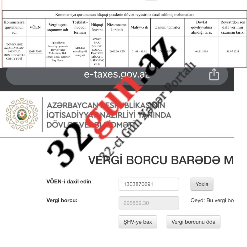 Efirlərdə bəh-bəhlə reklam olunan Dünya Göz Xəstəxanası vergidən yayınır?- 300 min manatlıq borc + Fotofakt