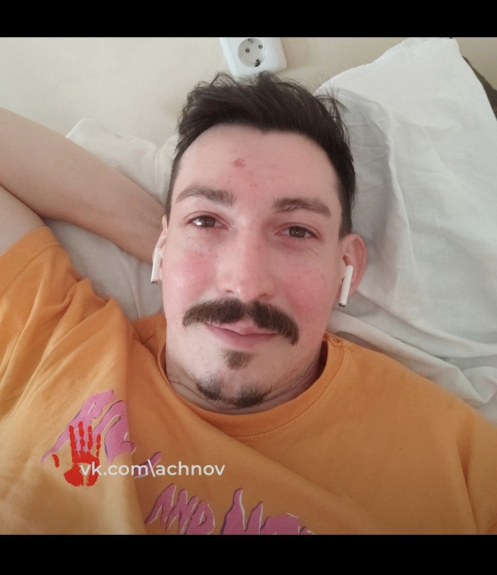 “Mercedes”in sürücüsü məşhur aktyorun kəlləsini sındırıb