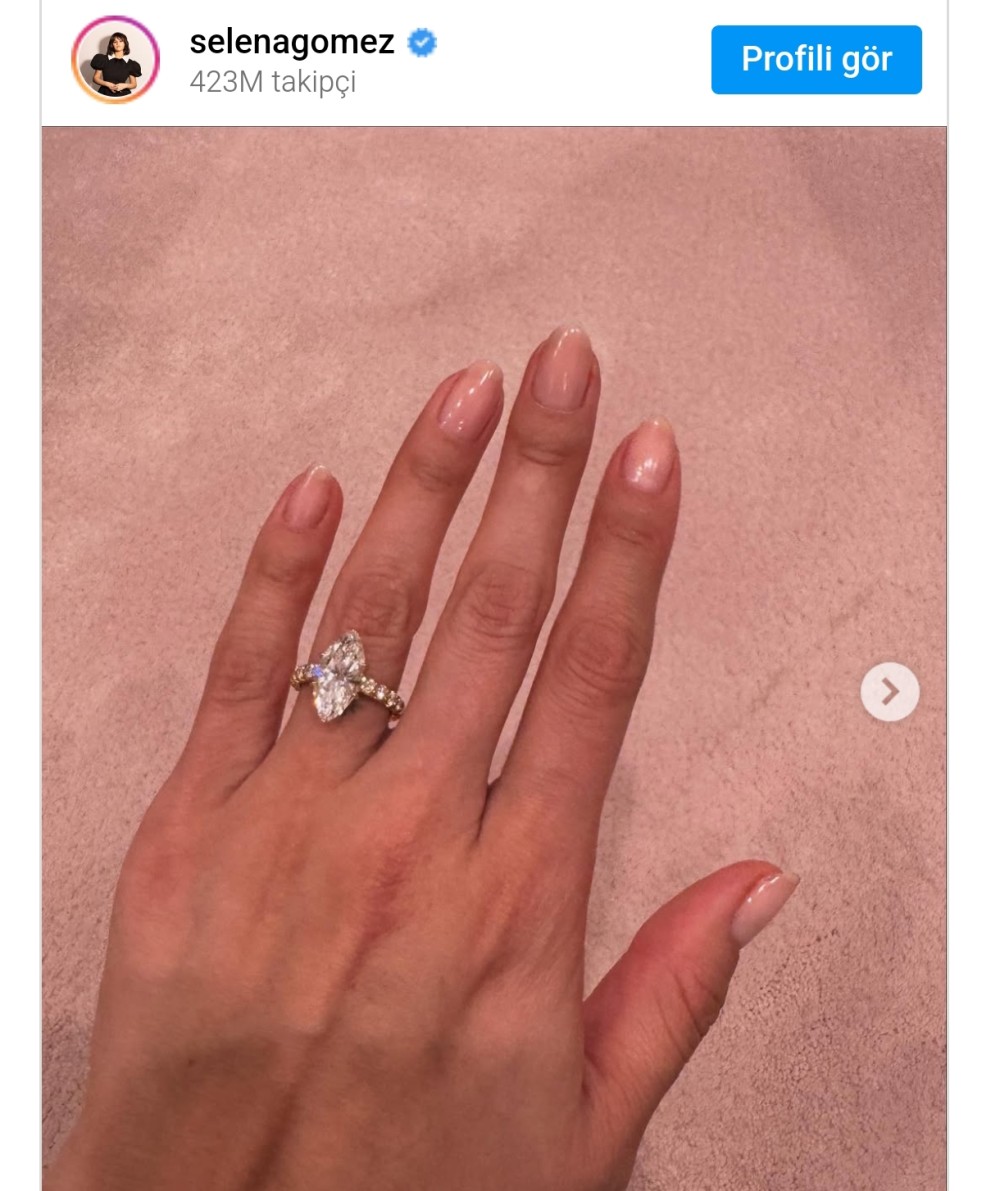 Məşhur müğənninin brilyant nişan üzüyünün qiyməti məlum olub- Fantastik məbləğdə/ FOTO