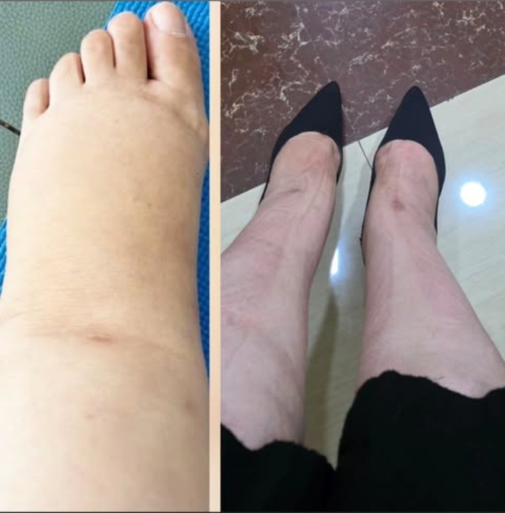 Aybəniz Haşımovanın səhhətində problem yarandı - FOTO